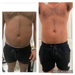 Body By Maggie Spa - Mommy make over treatment non invasive
