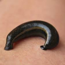 Texas Hijama And Leech Therapy