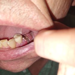 Superior Dental Health - Lincoln - Ouch!!!