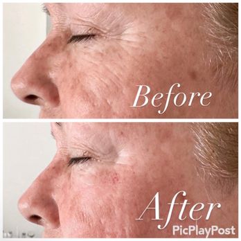 Cell Rejuvenation - Collagen Boosting Facial - Estheticians Near Me - Palm Desert, California Cell Rejuvenation - Collagen Boosting Facial - Estheticians Near Me - Palm Desert, California