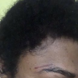 Aris did my eyebrows for $25 and left several burn marks this is just one of them