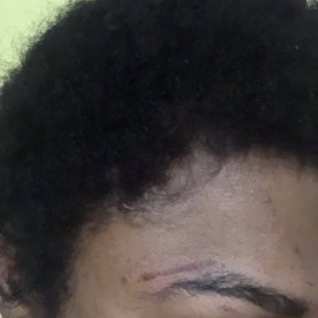 Aris Monyette Beauty - Aris did my eyebrows for $25 and left several burn marks this is just one of them - Skin Care Near Me - Gwynn, Maryland