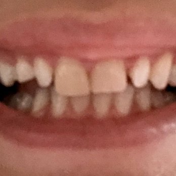 Orchard Lake Dentistry - Old bad teeth... - General Dentistry Near Me - Charlotte, North Carolina Orchard Lake Dentistry - Old bad teeth... - General Dentistry Near Me - Charlotte, North Carolina