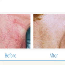 Pat Dalia's Laser & Electrolysis
