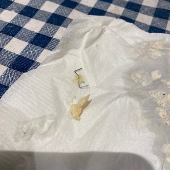 Villa du Souvlaki - Staple almost swallowed by my pregnant wife in her vegetarian souvlaki. - Greek Near Me - Montreal, Quebec Villa du Souvlaki - Staple almost swallowed by my pregnant wife in her vegetarian souvlaki. - Greek Near Me - Montreal, Quebec
