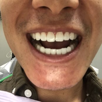 Ideal Dental Presidio - General Dentistry Near Me - Fort Worth, Texas Ideal Dental Presidio - General Dentistry Near Me - Fort Worth, Texas
