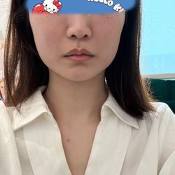 I A M Clinic - Face