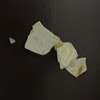 Fu Lam Mum - pieces of eggshell that was in my dish - Dim Sum Near Me - Mountain View, California Fu Lam Mum - pieces of eggshell that was in my dish - Dim Sum Near Me - Mountain View, California