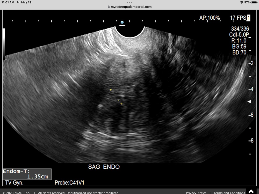 ADVANCED RADIOLOGY Updated September 2024 13 Reviews 7556 Teague