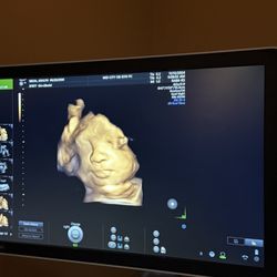 Mid-City OB-GYN - 3D ultrasound