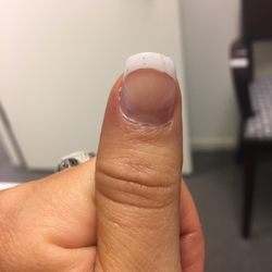 J C Nail - Nail 2 days after fill - completely peeling off and chipping.