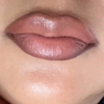 DermFx - 1yr later , second visit for fillers , Healed lips - Medical Spas Near Me - Orange, California DermFx - 1yr later , second visit for fillers , Healed lips - Medical Spas Near Me - Orange, California