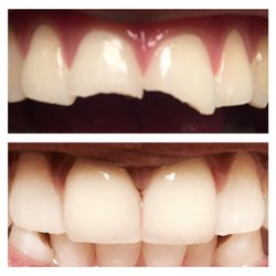 Cohen's Gentle Dental
