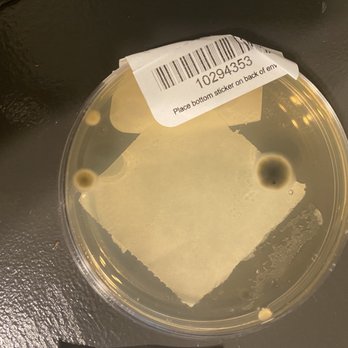 Eagles Walk Apartment Homes - MOLD growth within 24 hours of testing - Apartments Near Me - Rosedale, Maryland Eagles Walk Apartment Homes - MOLD growth within 24 hours of testing - Apartments Near Me - Rosedale, Maryland