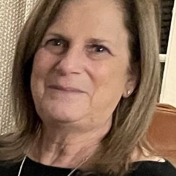Associated Plastic Surgeons - before surgery   brow low BUT no scar visible or lumps on my forehead. - Medical Spas Near Me - Leawood, Kansas