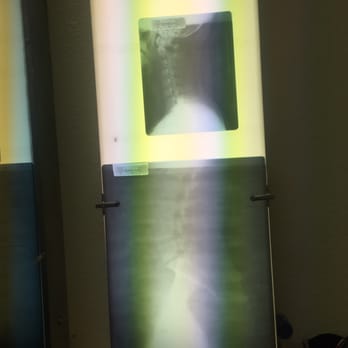 Hannah Chiropractic - I'm in phase 1 of degenerative disc disease - Chiropractors Near Me - Sacramento, California