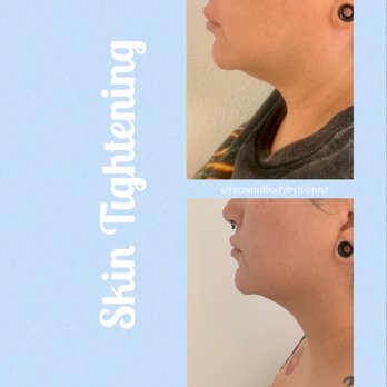 Bella Estetica - Skin Care Near Me - Chandler, Arizona Bella Estetica - Skin Care Near Me - Chandler, Arizona