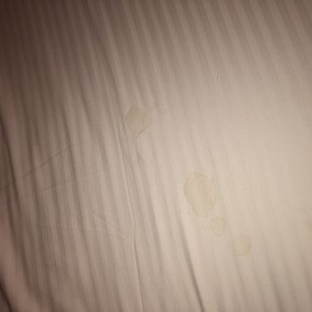 Omni Interlocken Hotel - Giant stains proving beds don't get clean - Hotels Near Me - Broomfield, Colorado