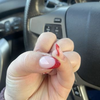 Allure Nails Spa - Red swollen peeling bleeding and sore to the touch - Nail Salons Near Me - Grass Valley, California Allure Nails Spa - Red swollen peeling bleeding and sore to the touch - Nail Salons Near Me - Grass Valley, California