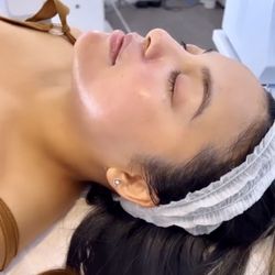 La Jolla Skin Studio - 5 in 1 with CBD skin resurfacing, skin bright peel, oxygen therapy, LED light therapy, + facial ironing
