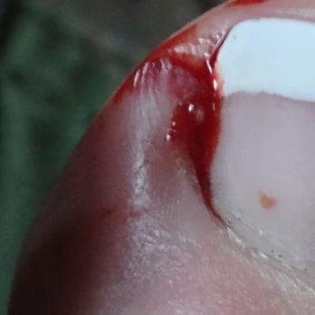 Pro Nails-Tom & Jennifer - Would not recommend getting pedicure from the new girl - Nail Salons Near Me - Crescent City, California Pro Nails-Tom & Jennifer - Would not recommend getting pedicure from the new girl - Nail Salons Near Me - Crescent City, California