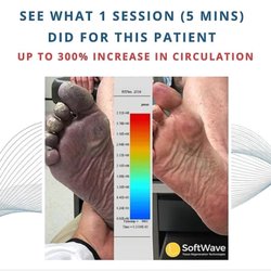 Golden Years Physical Therapy and Wellness - Difference Softwave can make in circulation for neuropathy and poor circulation