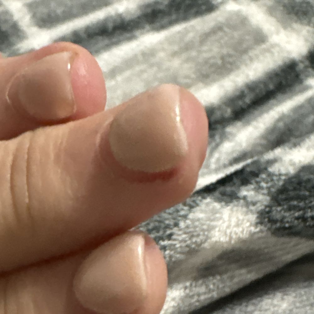 Hollywood Nails - See how thick and uneven - Nail Salons Near Me - Purcell, Oklahoma Hollywood Nails - See how thick and uneven - Nail Salons Near Me - Purcell, Oklahoma