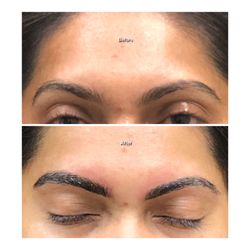 Omage Medispa - Microblading for improvement on definition