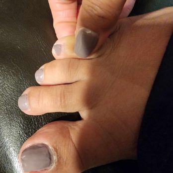 TN Nails Spa - Bad pedicure - Nail Salons Near Me - Pleasanton, California