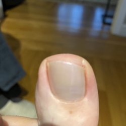 Begins Nail Spa - My toe hurts. Cut crooked and too short. I didn't ask for this.