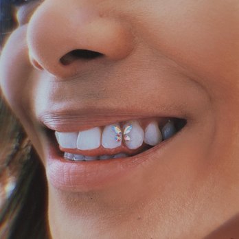 Heather Diamondz - Teeth Whitening Near Me Heather Diamondz - Teeth Whitening Near Me