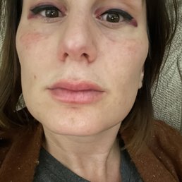 Healing the first session