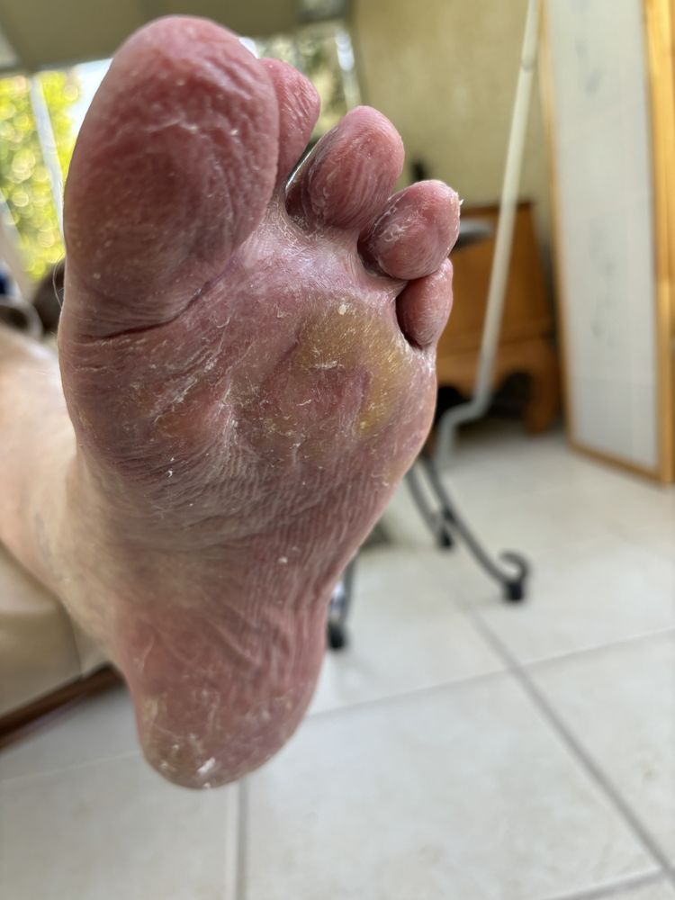 RNscrub Foot Care - home care agency in Santa Clara, CA