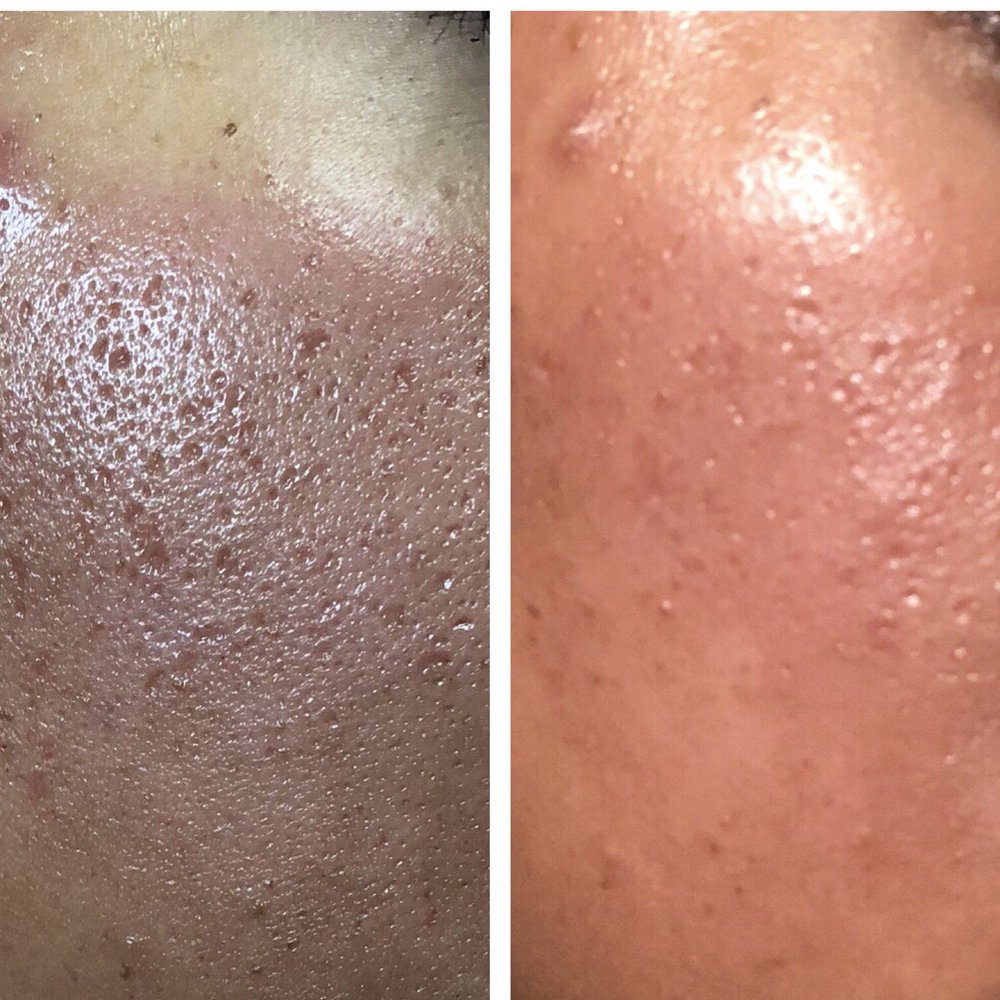 Esthetic Laser Clinic - Laser Hair Removal Near Me - Vienna, Virginia Esthetic Laser Clinic - Laser Hair Removal Near Me - Vienna, Virginia