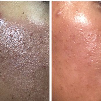 Esthetic Laser Clinic - Laser Hair Removal Near Me - Vienna, Virginia Esthetic Laser Clinic - Laser Hair Removal Near Me - Vienna, Virginia