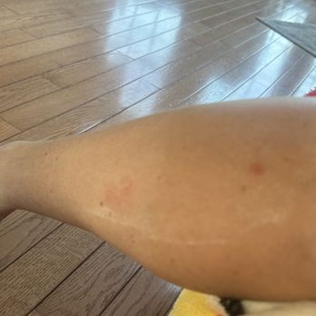Soho Nails & Spa - White stuff they left on my leg, this is after I tried to wipe it off - Waxing Near Me - Eureka, Missouri Soho Nails & Spa - White stuff they left on my leg, this is after I tried to wipe it off - Waxing Near Me - Eureka, Missouri