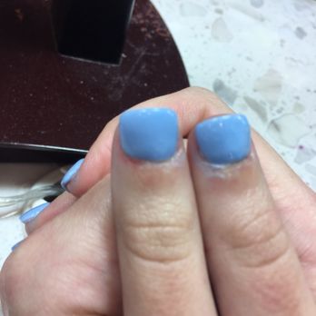 Snappy Nail Spa - left thumb is cut in cuticle area - Nail Salons Near Me - Deerfield Beach, Florida Snappy Nail Spa - left thumb is cut in cuticle area - Nail Salons Near Me - Deerfield Beach, Florida