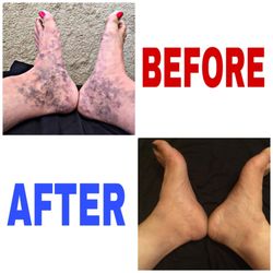 The Vein institute of phoenix