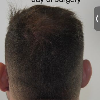 Charles Medical Group - Day of surgery - Cosmetic Surgeons Near Me - Boca Raton, Florida