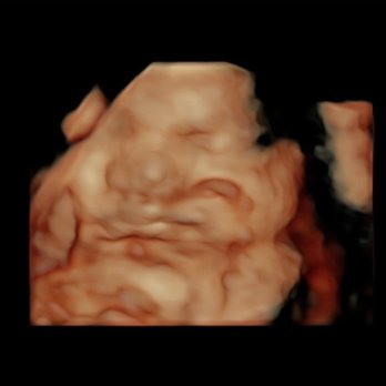 Sacramento Imaging - Face - Diagnostic Imaging Near Me - Sacramento, California