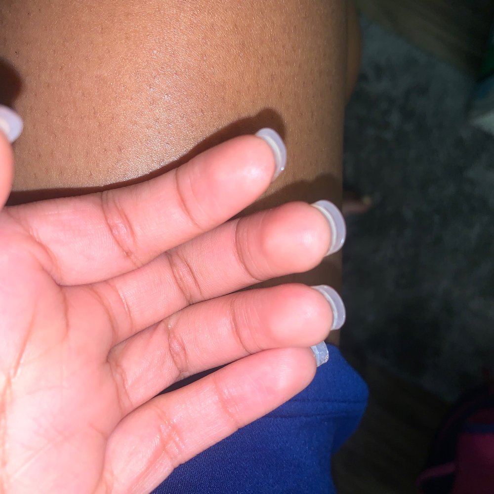 My Nail - my real nails are peeling off in the back. - Nail Salons Near Me - Catonsville, Maryland My Nail - my real nails are peeling off in the back. - Nail Salons Near Me - Catonsville, Maryland