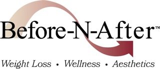 Before-N-After Logo