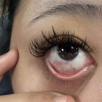 Vavi Lashes - the eye tape she misplaced and i was sitting there in pain for an hour. this is two days after and it's still red. - Eyelash Service Near Me - Cypress , California Vavi Lashes - the eye tape she misplaced and i was sitting there in pain for an hour. this is two days after and it's still red. - Eyelash Service Near Me - Cypress , California