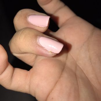 Q Nails - A week later, ring finger infected from cuticle trimmer cut. Notice the air bubbles and unevenness in polish, as well. - Nail Salons Near Me - Norwalk, California