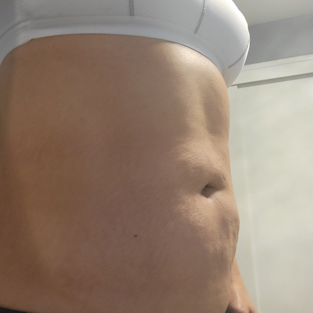 Solano Dermatology Vacaville, CA - Last Updated January 2026 - Yelp