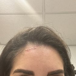 Albert Dabbah, MD - 1 week later