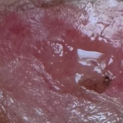 Manhattan Dermatology