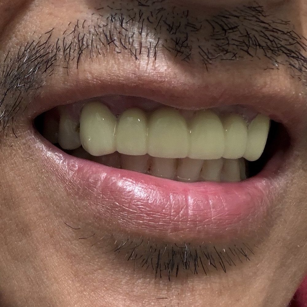 Cedar Smiles Dentistry - the old one - General Dentistry Near Me - Bellflower, California