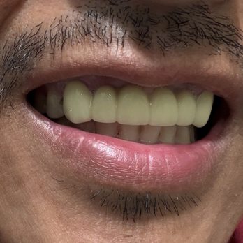 Cedar Smiles Dentistry - the old one - General Dentistry Near Me - Bellflower, California