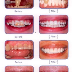 United Dental Group - Centreville - Whitening